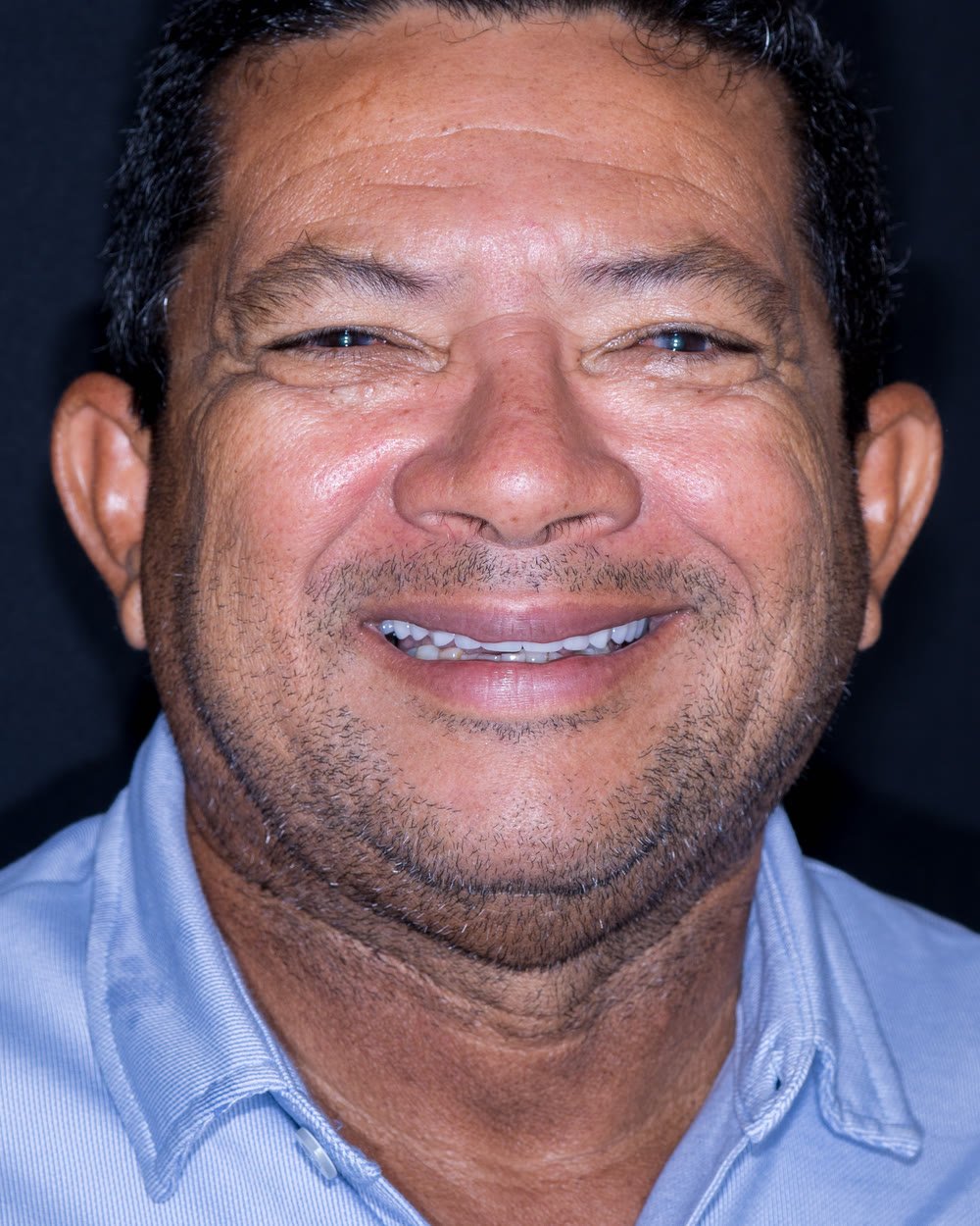 Eliésio depois, sorrindo com os dentes fixos